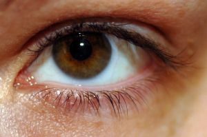 Cataracts: Causes, Symptoms, and Possible Treatments