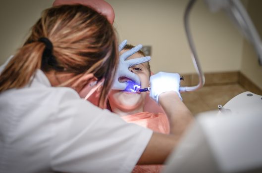 Dental Sealants A Way To Save Your Teeth From Decay