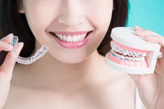 Invisalign A Better Replacement For Dental Braces