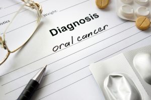 Oral Cancer Causes Symptoms Prevention And Treatments