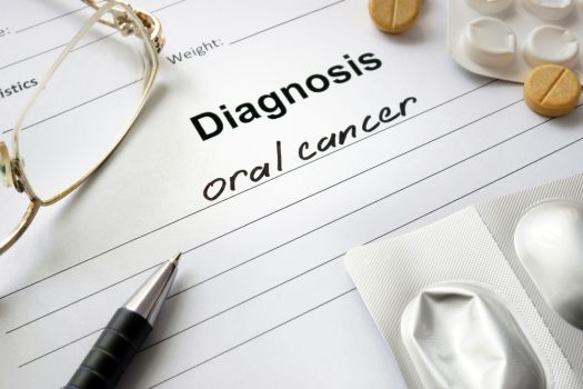 Oral Cancer Causes Symptoms Prevention And Treatments