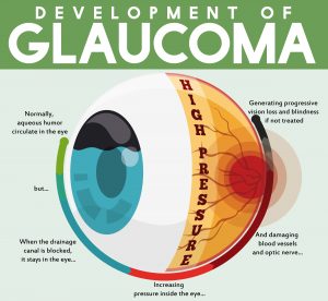 Top 7 Most Common Eye Conditions Symptoms And Treatments