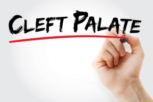 Cleft Lip And Cleft Palate Are Rare But They Deserve Attention