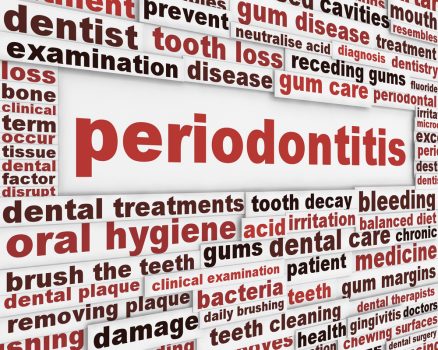 Gingivitis Causes Symptoms Prevention And Treatment