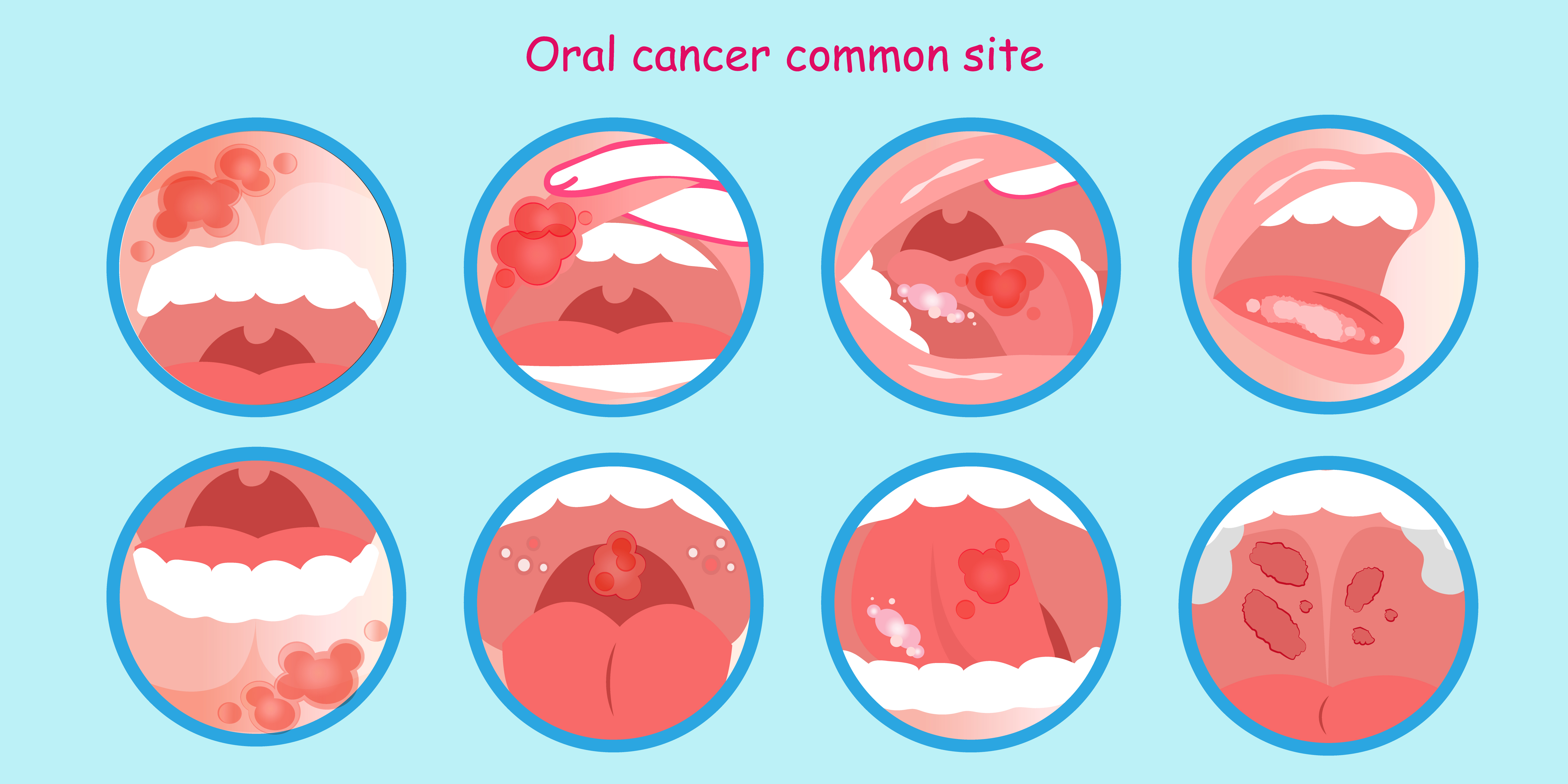 Oral Cancer Screening – A thorough Guide To The Service