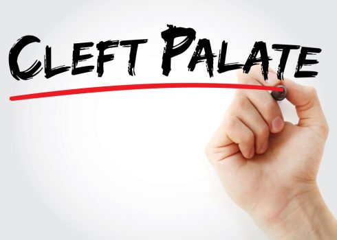 Is Cleft Lip And Cleft Palate Affecting You Or Your Loved Ones’ Lives?