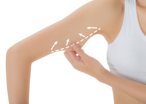 Liposuction An Overview Of The Plastic Surgery Procedure