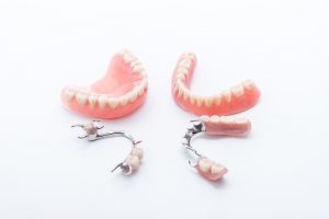 Dentures Steps Involved Advantages And Disadvantages