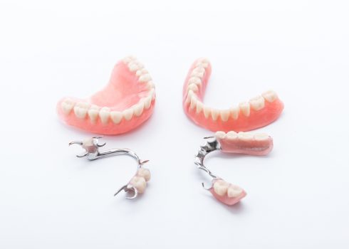 Dentures Steps Involved Advantages And Disadvantages